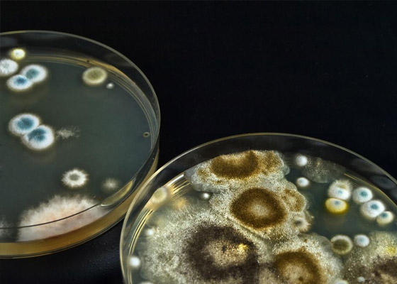 霉菌培養箱的溫度怎么設置